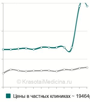 Средняя стоимость эндосонографии поджелудочной железы в Москве
