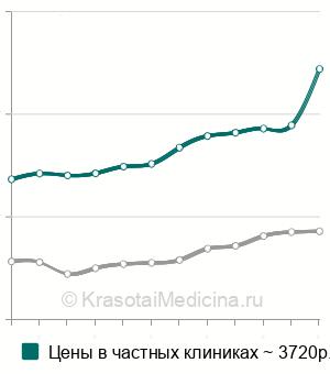 Средняя стоимость эхокардиографии (ЭхоКГ) в Москве
