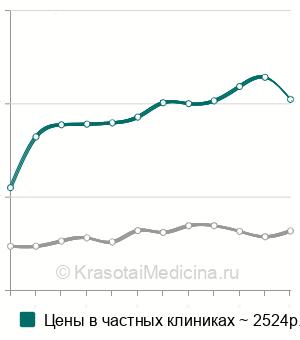 Средняя стоимость УЗИ прямой кишки в Москве