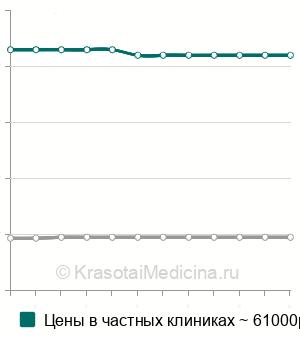 Средняя стоимость эндопротезирование пястно-фаланговых суставов в Москве