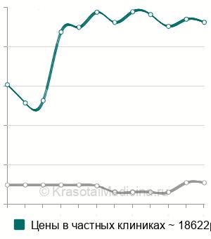 Средняя стоимость иссечения бурсы локтевого сустава в Москве