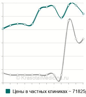 Средняя стоимость радиочастотная денервация фасеточных суставов в Москве