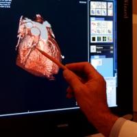 Новый метод МРТ-сканирования сердца сохранит здоровье почек