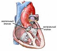 Доклад по теме Миокардиодистрофия вследствие физического перенапряжения