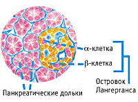 Панкреатогенный сахарный диабет