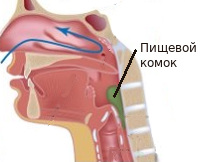 Лекция по теме Затруднение прохождения пищи по пищеводу