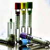 ПЦР-тест на уреаплазмоз (ureaplasma urealyticum)