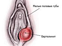 Бартолинит