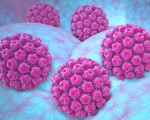 Папилломавирусная инфекция Папилломавирусная инфекция