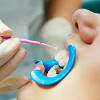 Глубокое фторирование зубов у детей