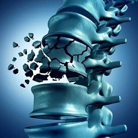 Соевая пища снижает риск переломов Соевая пища снижает риск переломов