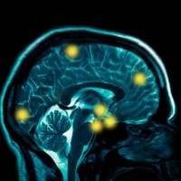 Толщина коры мозга влияет на работу нейронов