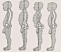 Реферат: Осанка. Типы нарушения осанки у детей и подростков. Профилактика нарушений осанки у детей и подр