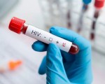Оппортунистические инфекции Оппортунистические инфекции