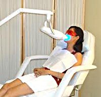 Процедура Лазерное отбеливание зубов