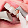 Удаление зубного налета AIR FLOW у детей