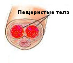 Кавернит Кавернит