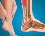 В коленях, икрах ног Болит внутренняя часть голени после бега или ходьбы