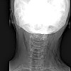 Рентген мягких тканей головы и шеи