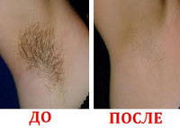Процедура 
