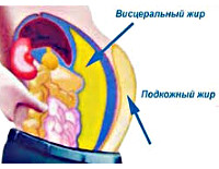 Абдоминальное ожирение - причины, симптомы, диагностика и лечение