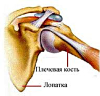 Артрит плечевого сустава