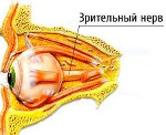 Ретробульбарный неврит