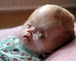 Аномалия денди уокера у взрослых что это. 3d57048e42a42f519c2660e14749408a. Аномалия денди уокера у взрослых что это фото. Аномалия денди уокера у взрослых что это-3d57048e42a42f519c2660e14749408a. картинка Аномалия денди уокера у взрослых что это. картинка 3d57048e42a42f519c2660e14749408a