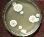 Aspergillus flavus что это 18