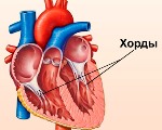 Дополнительная хорда сердца у ребенка