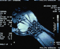 Процедура МРТ лучезапястного сустава