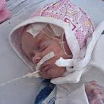 Асфиксия новорожденного Асфиксия новорожденного