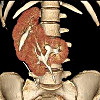 КТ почек ребенку