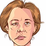 Слабость мышц лица Слабость мышц лица