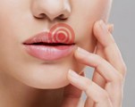Что такое лабиальный герпес лабиальный. Смотреть фото Что такое лабиальный герпес лабиальный. Смотреть картинку Что такое лабиальный герпес лабиальный. Картинка про Что такое лабиальный герпес лабиальный. Фото Что такое лабиальный герпес лабиальный
