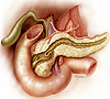 Абдоминизация поджелудочной железы