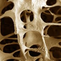 Обнаружен новый подход к лечению остеопороза