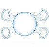Имплантация ИОЛ при афакии