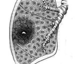 Реферат: Хронический абсцесс легкого