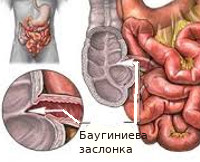 Баугинит