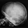 Рентген черепа ребенку