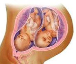 Два плодных яйца при беременности. Признаки многоплодной беременности и ее ведение. Признаки многоплодной беременности