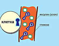 Сахарный диабет 1 типа