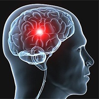 Ученые нашли новые причины болезни Паркинсона Ученые нашли новые причины болезни Паркинсона