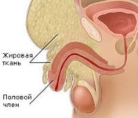 Как Выглядит Половой Член Фото