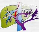 Признаки портальной гипертензии при циррозе и методы лечения