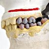 Восковое моделирование зуба