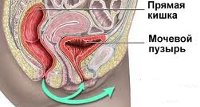 От чего происходит цистит у женщин 27