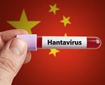 Хантавирусный кардиопульмональный синдром Хантавирусный кардиопульмональный синдром