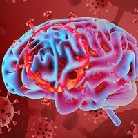 COVID-19 сопряжен с более тяжелыми инсультами у молодых пациентов COVID-19 сопряжен с более тяжелыми инсультами у молодых пациентов